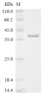 (Tris-Glycine gel) Discontinuous SDS-PAGE (reduced) with 5% enrichment gel and 15% separation gel.