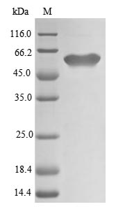 (Tris-Glycine gel) Discontinuous SDS-PAGE (reduced) with 5% enrichment gel and 15% separation gel. (Tris-Glycine gel) Discontinuous SDS-PAGE (reduced) with 5% enrichment gel and 15% separation gel.