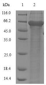 (Tris-Glycine gel) Discontinuous SDS-PAGE (reduced) with 5% enrichment gel and 15% separation gel.