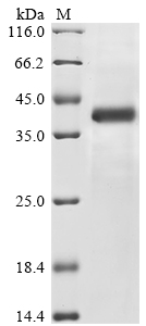 (Tris-Glycine gel) Discontinuous SDS-PAGE (reduced) with 5% enrichment gel and 15% separation gel. (Tris-Glycine gel) Discontinuous SDS-PAGE (reduced) with 5% enrichment gel and 15% separation gel.