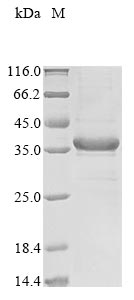 (Tris-Glycine gel) Discontinuous SDS-PAGE (reduced) with 5% enrichment gel and 15% separation gel. (Tris-Glycine gel) Discontinuous SDS-PAGE (reduced) with 5% enrichment gel and 15% separation gel.