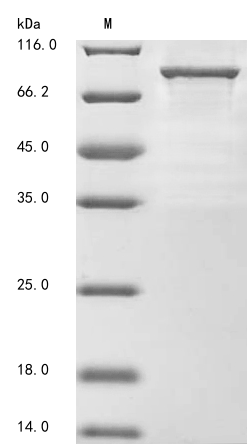 (Tris-Glycine gel) Discontinuous SDS-PAGE (reduced) with 5% enrichment gel and 15% separation gel. (Tris-Glycine gel) Discontinuous SDS-PAGE (reduced) with 5% enrichment gel and 15% separation gel.
