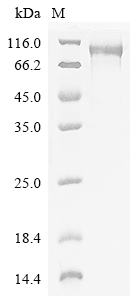 (Tris-Glycine gel) Discontinuous SDS-PAGE (reduced) with 5% enrichment gel and 15% separation gel. (Tris-Glycine gel) Discontinuous SDS-PAGE (reduced) with 5% enrichment gel and 15% separation gel.