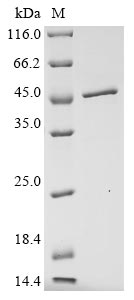 (Tris-Glycine gel) Discontinuous SDS-PAGE (reduced) with 5% enrichment gel and 15% separation gel.