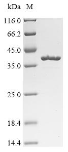 (Tris-Glycine gel) Discontinuous SDS-PAGE (reduced) with 5% enrichment gel and 15% separation gel.