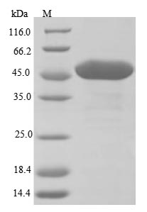 (Tris-Glycine gel) Discontinuous SDS-PAGE (reduced) with 5% enrichment gel and 15% separation gel. (Tris-Glycine gel) Discontinuous SDS-PAGE (reduced) with 5% enrichment gel and 15% separation gel.