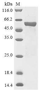 (Tris-Glycine gel) Discontinuous SDS-PAGE (reduced) with 5% enrichment gel and 15% separation gel. (Tris-Glycine gel) Discontinuous SDS-PAGE (reduced) with 5% enrichment gel and 15% separation gel.