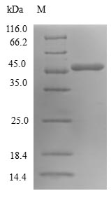 (Tris-Glycine gel) Discontinuous SDS-PAGE (reduced) with 5% enrichment gel and 15% separation gel. (Tris-Glycine gel) Discontinuous SDS-PAGE (reduced) with 5% enrichment gel and 15% separation gel.