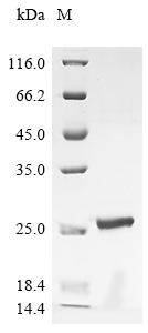 (Tris-Glycine gel) Discontinuous SDS-PAGE (reduced) with 5% enrichment gel and 15% separation gel. (Tris-Glycine gel) Discontinuous SDS-PAGE (reduced) with 5% enrichment gel and 15% separation gel.