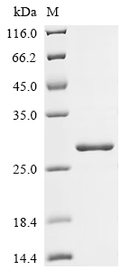 (Tris-Glycine gel) Discontinuous SDS-PAGE (reduced) with 5% enrichment gel and 15% separation gel.