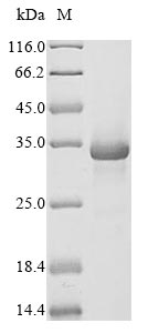 (Tris-Glycine gel) Discontinuous SDS-PAGE (reduced) with 5% enrichment gel and 15% separation gel. (Tris-Glycine gel) Discontinuous SDS-PAGE (reduced) with 5% enrichment gel and 15% separation gel.