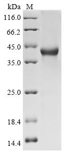 (Tris-Glycine gel) Discontinuous SDS-PAGE (reduced) with 5% enrichment gel and 15% separation gel. (Tris-Glycine gel) Discontinuous SDS-PAGE (reduced) with 5% enrichment gel and 15% separation gel.