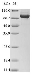 (Tris-Glycine gel) Discontinuous SDS-PAGE (reduced) with 5% enrichment gel and 15% separation gel. (Tris-Glycine gel) Discontinuous SDS-PAGE (reduced) with 5% enrichment gel and 15% separation gel.