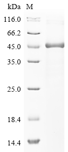 (Tris-Glycine gel) Discontinuous SDS-PAGE (reduced) with 5% enrichment gel and 15% separation gel. (Tris-Glycine gel) Discontinuous SDS-PAGE (reduced) with 5% enrichment gel and 15% separation gel.