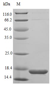(Tris-Glycine gel) Discontinuous SDS-PAGE (reduced) with 5% enrichment gel and 15% separation gel. (Tris-Glycine gel) Discontinuous SDS-PAGE (reduced) with 5% enrichment gel and 15% separation gel.