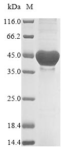 SDS-PAGE- Recombinant protein Neisseria nadA