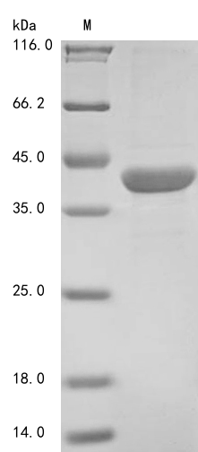 (Tris-Glycine gel) Discontinuous SDS-PAGE (reduced) with 5% enrichment gel and 15% separation gel.