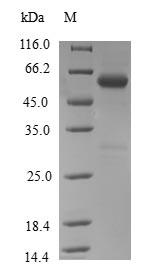 (Tris-Glycine gel) Discontinuous SDS-PAGE (reduced) with 5% enrichment gel and 15% separation gel. (Tris-Glycine gel) Discontinuous SDS-PAGE (reduced) with 5% enrichment gel and 15% separation gel.