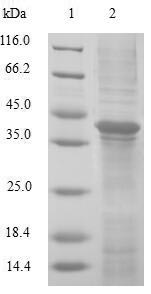 (Tris-Glycine gel) Discontinuous SDS-PAGE (reduced) with 5% enrichment gel and 15% separation gel. (Tris-Glycine gel) Discontinuous SDS-PAGE (reduced) with 5% enrichment gel and 15% separation gel.