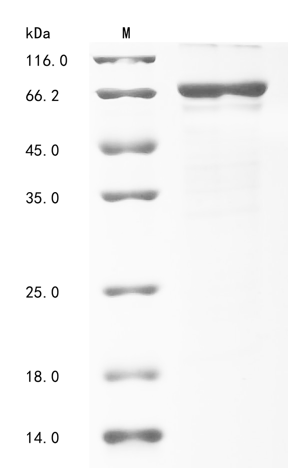 (Tris-Glycine gel) Discontinuous SDS-PAGE (reduced) with 5% enrichment gel and 15% separation gel. (Tris-Glycine gel) Discontinuous SDS-PAGE (reduced) with 5% enrichment gel and 15% separation gel.