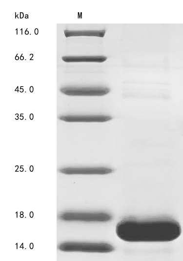 (Tris-Glycine gel) Discontinuous SDS-PAGE (reduced) with 5% enrichment gel and 15% separation gel.