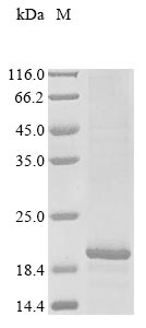 (Tris-Glycine gel) Discontinuous SDS-PAGE (reduced) with 5% enrichment gel and 15% separation gel. (Tris-Glycine gel) Discontinuous SDS-PAGE (reduced) with 5% enrichment gel and 15% separation gel.