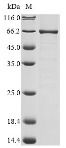 (Tris-Glycine gel) Discontinuous SDS-PAGE (reduced) with 5% enrichment gel and 15% separation gel. (Tris-Glycine gel) Discontinuous SDS-PAGE (reduced) with 5% enrichment gel and 15% separation gel.