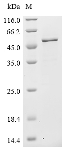 (Tris-Glycine gel) Discontinuous SDS-PAGE (reduced) with 5% enrichment gel and 15% separation gel. (Tris-Glycine gel) Discontinuous SDS-PAGE (reduced) with 5% enrichment gel and 15% separation gel.