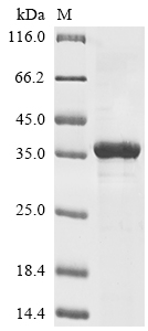 (Tris-Glycine gel) Discontinuous SDS-PAGE (reduced) with 5% enrichment gel and 15% separation gel. (Tris-Glycine gel) Discontinuous SDS-PAGE (reduced) with 5% enrichment gel and 15% separation gel.