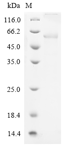 (Tris-Glycine gel) Discontinuous SDS-PAGE (reduced) with 5% enrichment gel and 15% separation gel. (Tris-Glycine gel) Discontinuous SDS-PAGE (reduced) with 5% enrichment gel and 15% separation gel.