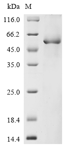 (Tris-Glycine gel) Discontinuous SDS-PAGE (reduced) with 5% enrichment gel and 15% separation gel. (Tris-Glycine gel) Discontinuous SDS-PAGE (reduced) with 5% enrichment gel and 15% separation gel.