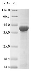 (Tris-Glycine gel) Discontinuous SDS-PAGE (reduced) with 5% enrichment gel and 15% separation gel.