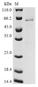 (Tris-Glycine gel) Discontinuous SDS-PAGE (reduced) with 5% enrichment gel and 15% separation gel. (Tris-Glycine gel) Discontinuous SDS-PAGE (reduced) with 5% enrichment gel and 15% separation gel.
