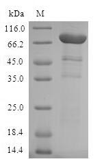 (Tris-Glycine gel) Discontinuous SDS-PAGE (reduced) with 5% enrichment gel and 15% separation gel. (Tris-Glycine gel) Discontinuous SDS-PAGE (reduced) with 5% enrichment gel and 15% separation gel.