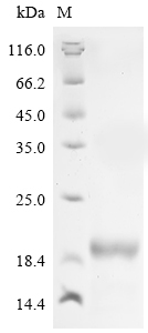 (Tris-Glycine gel) Discontinuous SDS-PAGE (reduced) with 5% enrichment gel and 15% separation gel. (Tris-Glycine gel) Discontinuous SDS-PAGE (reduced) with 5% enrichment gel and 15% separation gel.