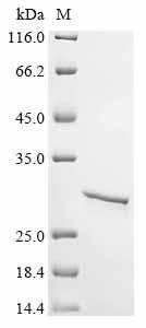 (Tris-Glycine gel) Discontinuous SDS-PAGE (reduced) with 5% enrichment gel and 15% separation gel. (Tris-Glycine gel) Discontinuous SDS-PAGE (reduced) with 5% enrichment gel and 15% separation gel.