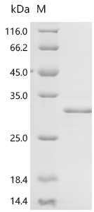 (Tris-Glycine gel) Discontinuous SDS-PAGE (reduced) with 5% enrichment gel and 15% separation gel.