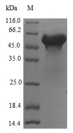 (Tris-Glycine gel) Discontinuous SDS-PAGE (reduced) with 5% enrichment gel and 15% separation gel. (Tris-Glycine gel) Discontinuous SDS-PAGE (reduced) with 5% enrichment gel and 15% separation gel.