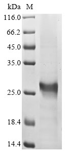 (Tris-Glycine gel) Discontinuous SDS-PAGE (reduced) with 5% enrichment gel and 15% separation gel. (Tris-Glycine gel) Discontinuous SDS-PAGE (reduced) with 5% enrichment gel and 15% separation gel.