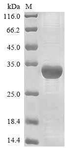 (Tris-Glycine gel) Discontinuous SDS-PAGE (reduced) with 5% enrichment gel and 15% separation gel. (Tris-Glycine gel) Discontinuous SDS-PAGE (reduced) with 5% enrichment gel and 15% separation gel.