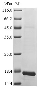 (Tris-Glycine gel) Discontinuous SDS-PAGE (reduced) with 5% enrichment gel and 15% separation gel. (Tris-Glycine gel) Discontinuous SDS-PAGE (reduced) with 5% enrichment gel and 15% separation gel.