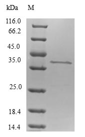 (Tris-Glycine gel) Discontinuous SDS-PAGE (reduced) with 5% enrichment gel and 15% separation gel. (Tris-Glycine gel) Discontinuous SDS-PAGE (reduced) with 5% enrichment gel and 15% separation gel.