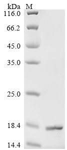 (Tris-Glycine gel) Discontinuous SDS-PAGE (reduced) with 5% enrichment gel and 15% separation gel. (Tris-Glycine gel) Discontinuous SDS-PAGE (reduced) with 5% enrichment gel and 15% separation gel.