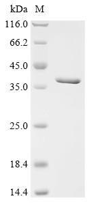 (Tris-Glycine gel) Discontinuous SDS-PAGE (reduced) with 5% enrichment gel and 15% separation gel.