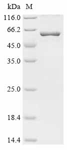 (Tris-Glycine gel) Discontinuous SDS-PAGE (reduced) with 5% enrichment gel and 15% separation gel. (Tris-Glycine gel) Discontinuous SDS-PAGE (reduced) with 5% enrichment gel and 15% separation gel.