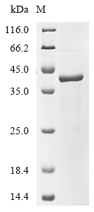(Tris-Glycine gel) Discontinuous SDS-PAGE (reduced) with 5% enrichment gel and 15% separation gel.
