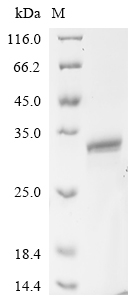 (Tris-Glycine gel) Discontinuous SDS-PAGE (reduced) with 5% enrichment gel and 15% separation gel. (Tris-Glycine gel) Discontinuous SDS-PAGE (reduced) with 5% enrichment gel and 15% separation gel.