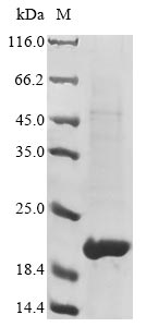 (Tris-Glycine gel) Discontinuous SDS-PAGE (reduced) with 5% enrichment gel and 15% separation gel. (Tris-Glycine gel) Discontinuous SDS-PAGE (reduced) with 5% enrichment gel and 15% separation gel.