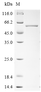 (Tris-Glycine gel) Discontinuous SDS-PAGE (reduced) with 5% enrichment gel and 15% separation gel. (Tris-Glycine gel) Discontinuous SDS-PAGE (reduced) with 5% enrichment gel and 15% separation gel.