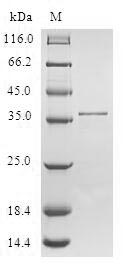 (Tris-Glycine gel) Discontinuous SDS-PAGE (reduced) with 5% enrichment gel and 15% separation gel. (Tris-Glycine gel) Discontinuous SDS-PAGE (reduced) with 5% enrichment gel and 15% separation gel.